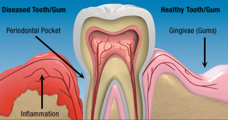 hygiene3